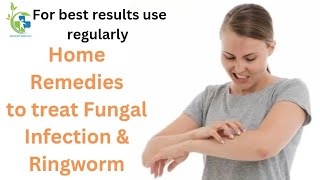 HOME REMEDIES TO TREAT FUNGAL INFECTION amp RINGWORM [upl. by Saunder657]