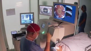 Laser Assisted Cataract Surgery procedure amp settings [upl. by Libbi]