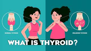 Thyroid Gland T3 T4 Thyroid Hormones and Thyroid Problems Animation thyroid [upl. by Nosyarg]