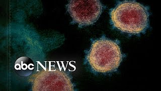 Case of ‘community spread’ of coronavirus in US raises concerns  WNT [upl. by Halona]