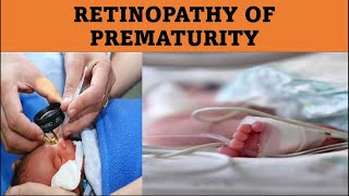 What Causes ROP  Retinopathy of prematurity [upl. by Satsoc]