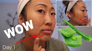 I USED FRESH ALOE VERA FOR 7 DAYS AND LOOK WHAT HAPPENED [upl. by Noiro505]