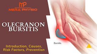 Olecranon Bursitis  Intro Causes Risk Factors Prevention  In Hindi  Mera Physio [upl. by Bergmann]