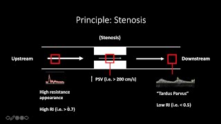 Doppler Ultrasound Part 1  Principles w focus on Spectral Waveforms [upl. by Lebanna]