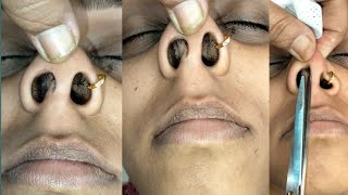 Nose hair cuttingHow to do nose hair cuttingpiggynosenosehaircutting nosepullingnosemassage [upl. by Ahsekad]