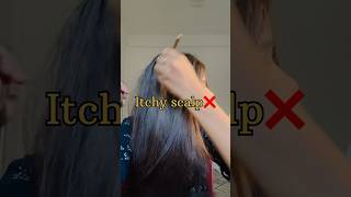 quotFix Itchy Scalp Simple Remedy That Work Wonder” 🌿shorts haircare hairgrowth [upl. by Woermer]