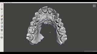 Encerado Digital usando Meshmixer  Odontología Digital [upl. by Duntson]