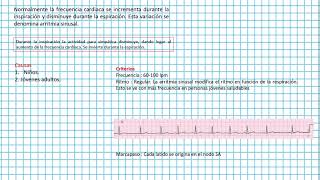 Arritmia SINUSAL  Clases EKG 37 [upl. by Araf647]