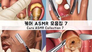 ASMR 케어 애니메이션 모음집7 내성발톱머릿니충치사랑니  CARE ANIMATION COLLECTION7 Ingrown toenailshead licecavities [upl. by Eixela]