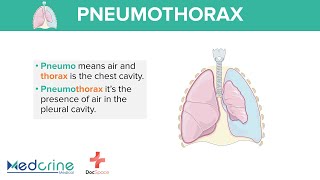 Pneumothorax Definition Types and classification Preview [upl. by Michaele]