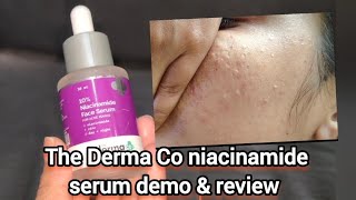 The Derma Co niacinamide serum demo amp review  how to use niacinamide serum rRmivlogs53 [upl. by Onilatac]