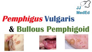 Vesiculobullous Skin Diseases  Pemphigus Vulgaris vs Bullous Pemphigoid [upl. by Yahsan]