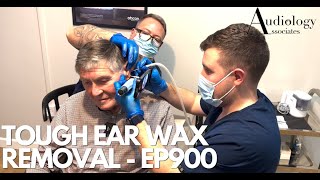 TOUGH EAR WAX REMOVAL IT TOOK BOTH OF US TO REMOVE   EP900 [upl. by Sherm]