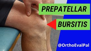 Prepatellar Bursitis Anterior knee pain and swelling [upl. by Nylssej]