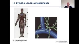 Video 1  Selbstmanagement in der Lymphologie  Grundlagen [upl. by Helene]