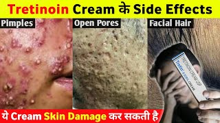 Tretinoin Cream के ये Side Effects आप नहीं जानते होगे 😱 [upl. by Stead745]