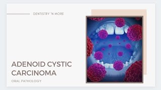 ADENOID CYSTIC CARCINOMA [upl. by Suhploda546]