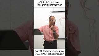 Clinical Features Of Intracranial Haemorrhages shortvideo shorts drnajeeb drnajeeblectures [upl. by Nosyrb]