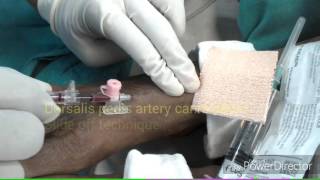 Dorsalis pedis artery cannulation [upl. by Anawait]