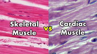 Differentiating Skeletal Muscle and Cardiac Muscle  Striations vs Intercalated Discs [upl. by Abekam877]