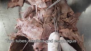 Thyroid gland  Dissection [upl. by Nosniv]