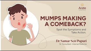 Mumps Causes Symptoms and Treatments  Dr Samar Sen P  Arete Hospitals mumps [upl. by Filmer]