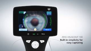 VISUSCOUT 100 from ZEISS  Handheld Fundus Camera [upl. by Acirrej599]