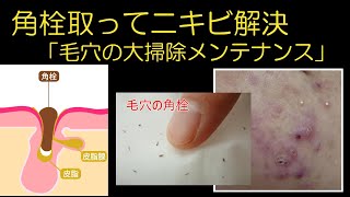 【解決】角栓取ってニキビ解決 毛穴の大掃除 acne pores 美容 素肌の総合研究所 毛穴 ニキビ [upl. by Mcwilliams298]