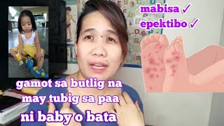 Paano Gamutin Ang Butlig Na May Tubig Sa Paa Ni Baby O Bata [upl. by Auburta]