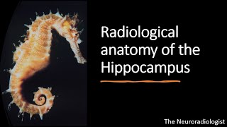 Unforgettable Radiological Anatomy of the Hippocampus [upl. by Yellek]