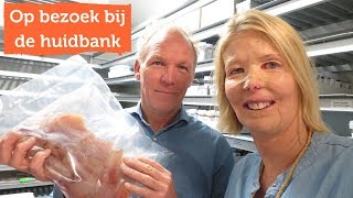 HUIDBANK  Donorhuid als natuurlijk verband [upl. by Eben549]