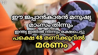 30വയസ്സിനു മേലെ ഉള്ളവർ സൂക്ഷിക്കുക 😳😳FLESH EATING BACTERIA JAPAN MALAYALAM TALKSOFKITCHEES [upl. by Janyte134]