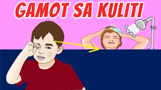 GAMOT SA KULITI BUTLIG SA MATA BAKIT NANGANGATI TALUKAP PILIK MATA IMPEKSIYON EYE STYE MUTA [upl. by Wrand]