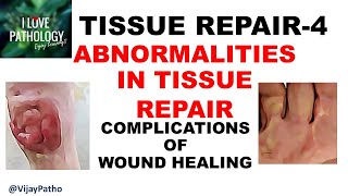 TISSUE REPAIR Part 1 Repair  Regeneration [upl. by Megdal]