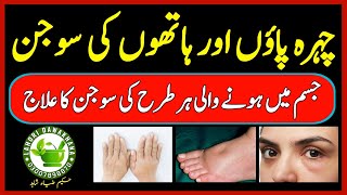 Hath Paon Aur chehre ki sojan ka ilaj  Face Hands And Feet Swellin Treatment  Hakeem Zia Shahid [upl. by Einned]