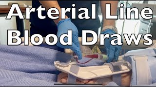 Drawing Blood from an Arterial Line [upl. by Tillio]