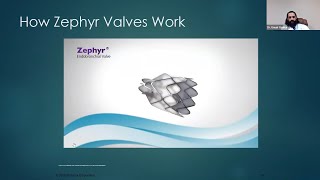 Zephyr Endobronchial Valves A treatment to reduce hyperinflation in patients with severe emphysema [upl. by Pomeroy397]