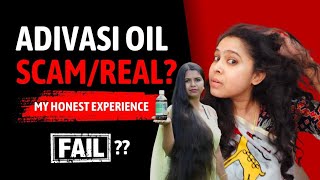 Adivasi Oil FAIL 2 Months Honest Review adivasihairoil anantambani haircare crownsaesthetics [upl. by Kinna805]