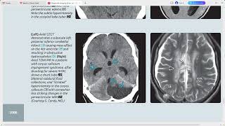 BRAIN DIAGNOSTIC IMAGING SERIES [upl. by Tien]