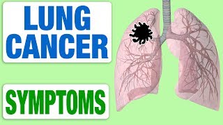 Lung Cancer  All Symptoms [upl. by Runck]