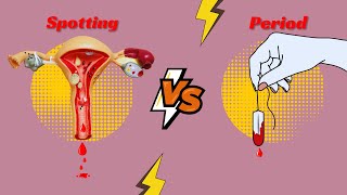 Spotting VS Period 🔴 7 Key Difference Between Spotting and Period [upl. by Lemrahc230]