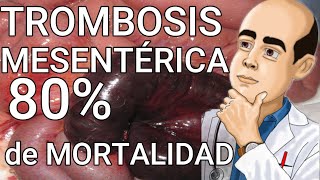 Trombosis Mesentérica e Isquemia Aguda No OCLUSIVA del Colon Anatomia  80  de MORTALIDAD USMLE [upl. by Tabbie]