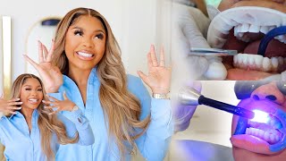 VLOG I GOT MY TEETH DONE IN TURKEY BEST VENEERS EVER w Prime Dental [upl. by Lais]