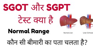 SGOT Blood Test  SGPT Blood Test  ALT  AST  SGOT amp SGPT Test Normal RangeMLTLabManual20 [upl. by Nahtahoj]