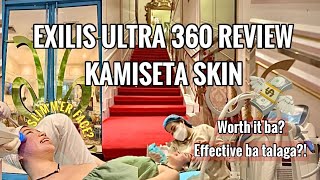 NON INVASIVE TREATMENT REVIEW Exilis Ultra 360 Experience at Kamiseta Skin BGC 2023 [upl. by Hanimay]