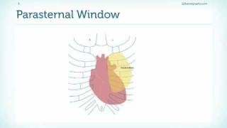 Introduction to the Parasternal Window [upl. by Navad387]