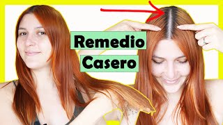 💁‍♀️ MASCARILLA de CEBOLLA 🧅para ELIMINAR la CAÍDA DEL CABELLO y hacer CRECERLO 🤗 [upl. by Taimi]