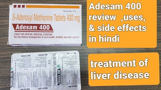 Adesam 400 review uses ampside effects [upl. by Rodi660]