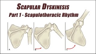 Fix Your Scapular Dyskinesis Part 1  Scapulothoracic Rhythm Exercises [upl. by Helmer228]