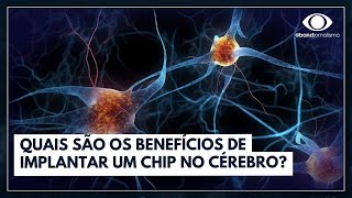 Chip no cérebro quais são os benefícios e riscos  Band em Alta [upl. by Asiole993]